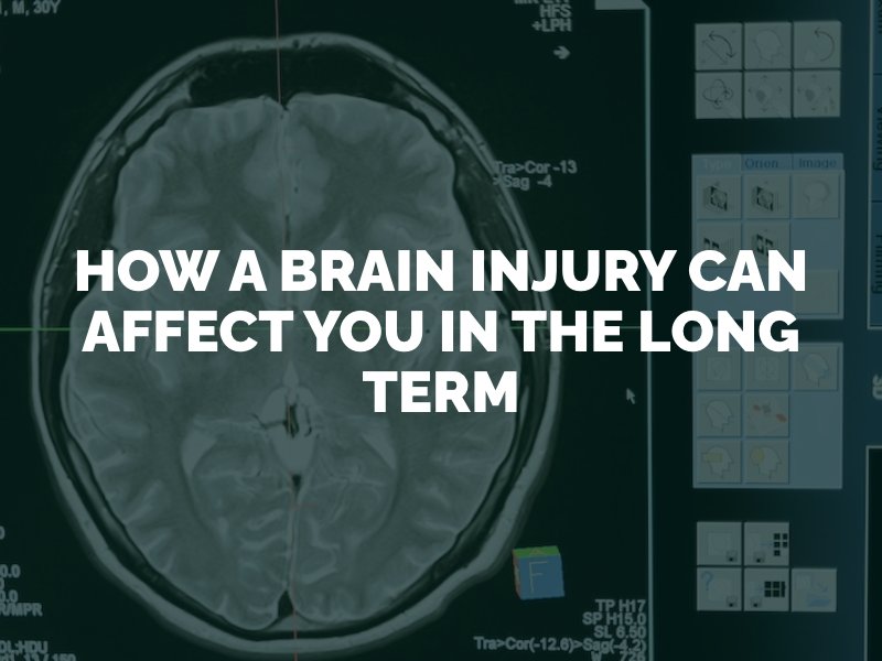 How a Brain Injury Can Affect You in the Long Term