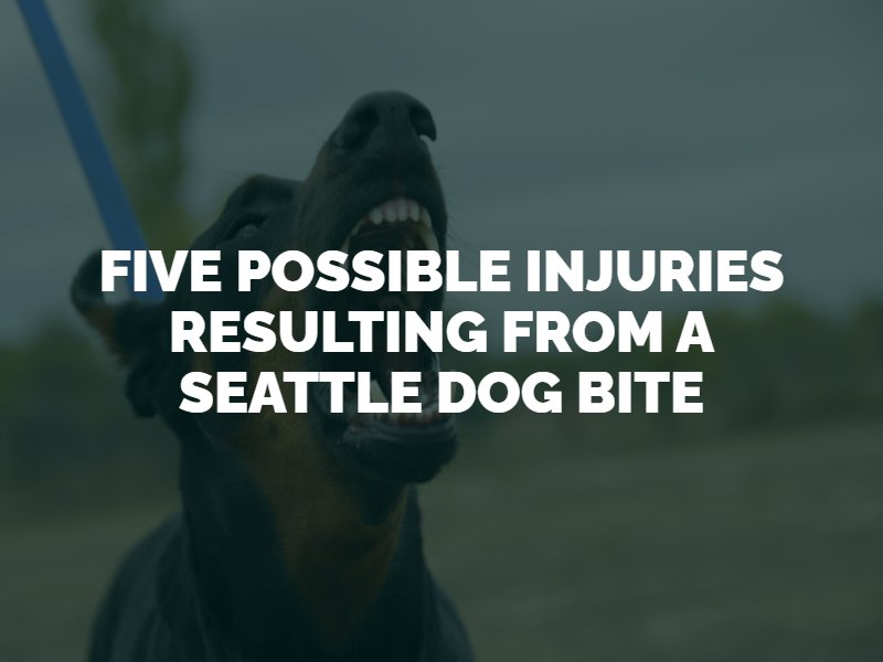 seattle dog bite attorney