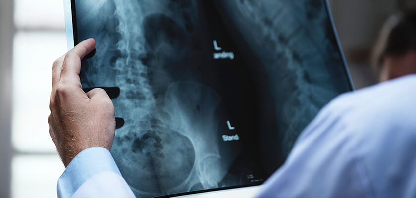 Doctor examining x-ray of spinal cord